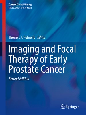 cover image of Imaging and Focal Therapy of Early Prostate Cancer
